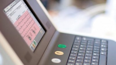 El Gobierno nacional recuperó más de 30 electrocardiógrafos abandonados en un depósito
